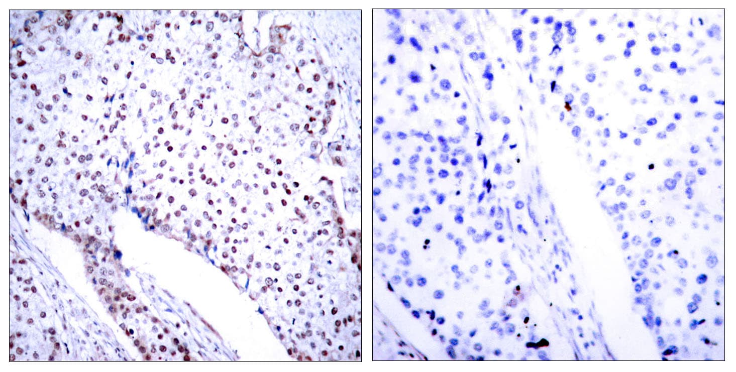STAT3 Antibody (aa672-721)