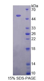 Rat GFAP Protein (Recombinant His-T7)