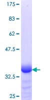Human KLF15 Protein (Recombinant GST, N-terminus)