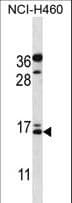 Osteocalcin Antibody (aa23-52)