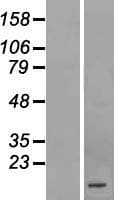 C1orf210 Protein (Over-Expression Lysate Myc-DDK (Flag))