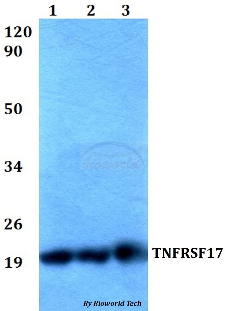 Polyclonal Rabbit anti-Human TNFRSF17 / BCMA Antibody (WB)