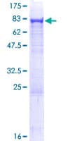 Human ASNS Protein (Recombinant GST)