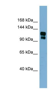 Polyclonal Rabbit anti-Human TRPA1 Antibody (aa539-588, WB)