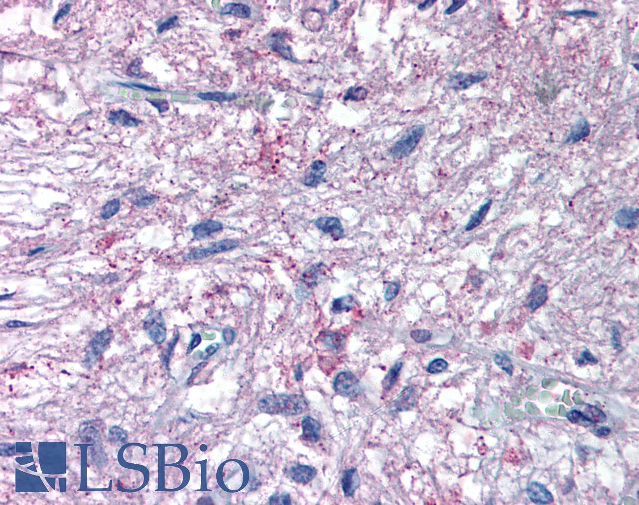 IHC-plus™ GPR50 Antibody (C-Terminus)
