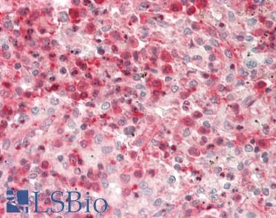 TNFAIP3 / A20 Antibody (aa357-406)