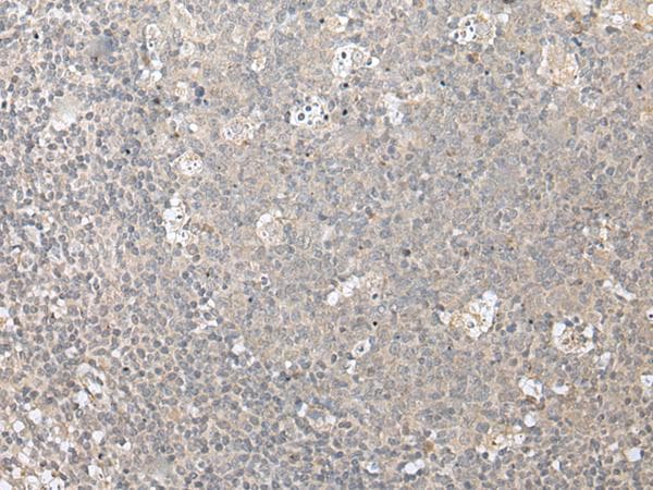 ZFYVE1 / DFCP1 Antibody