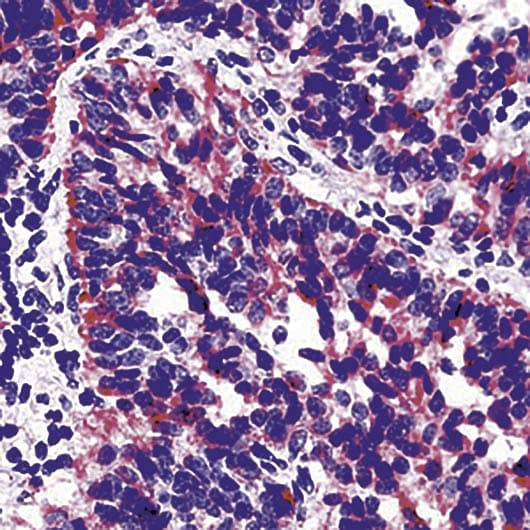 TIMP2 Antibody (N-Terminus, clone 3A4)