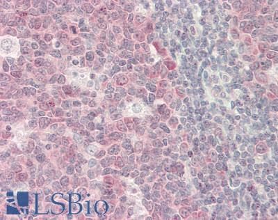IHC-plus™ FDPS Antibody