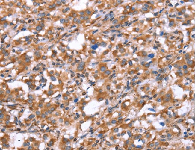 IHC-plus™ GPC6 / Glypican 6 Antibody