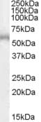 ADRB1 Antibody (aa202-214)