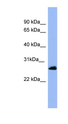 Polyclonal Rabbit anti-Human RAB5A / RAB5 Antibody (C-Terminus, WB)