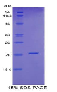 Human FBN1 / Fibrillin 1 Protein (Recombinant 6His, N-terminus)