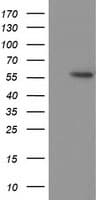 TP53 / p53 Antibody (clone OTI1D11, Carrier-free)