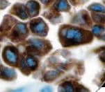 Tyrosinase Antibody (Ready-to-Use)