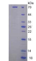 Human LGALS9 / Galectin 9 Protein (Recombinant His-GST)