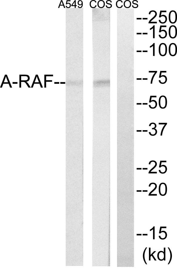 Polyclonal Rabbit anti-Human ARAF / ARAF1 / A-RAF Antibody (IHC, WB)