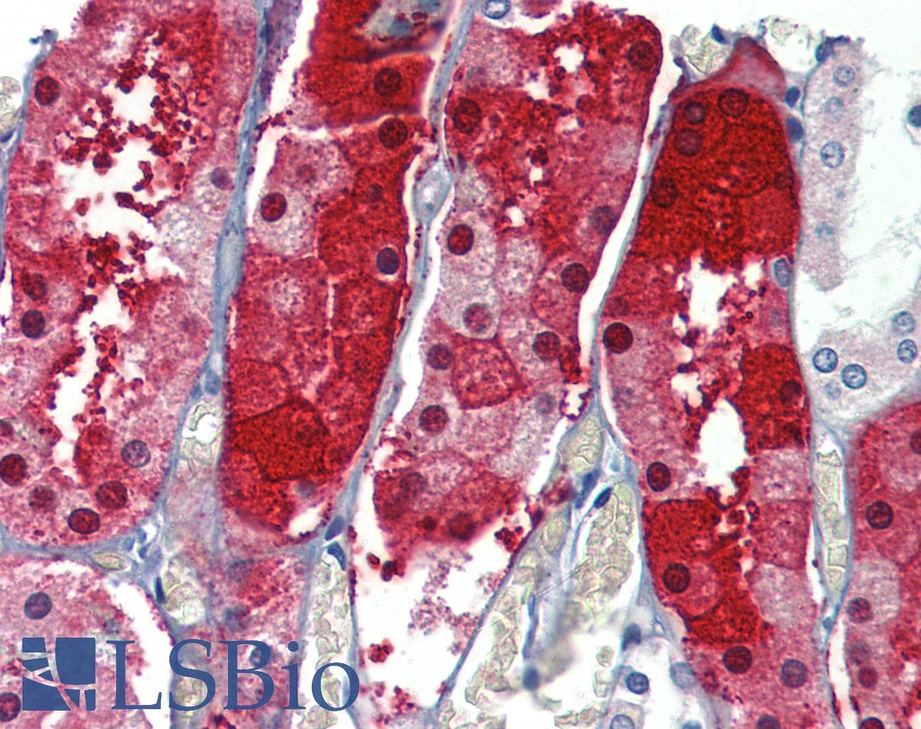 IHC-plus™ Polyclonal Rabbit anti-Human JPH4 Antibody (IHC, WB)