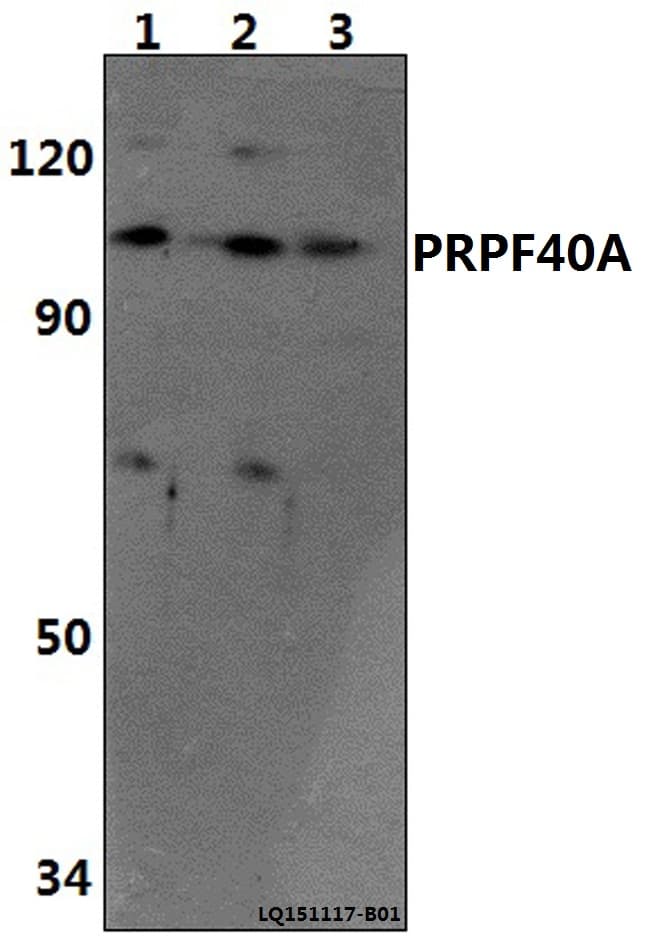 PRPF40A / FNBP3 Antibody