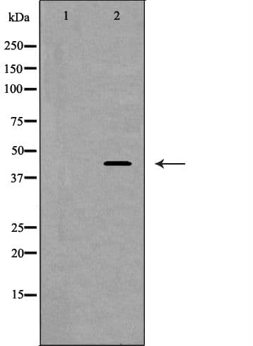 Polyclonal Rabbit anti-Human PGC / Pepsin C Antibody (IHC, IF, WB)