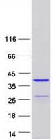 Human SYCE1L Protein (Recombinant Myc-DDK (Flag))
