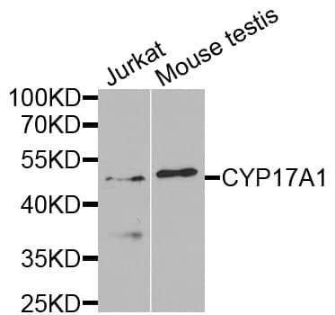 Polyclonal Rabbit anti-Human CYP17 / CYP17A1 Antibody (IHC, WB)