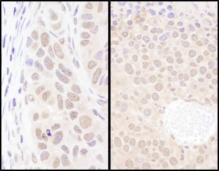 PSIP1 / LEDGF Antibody (aa225-275)