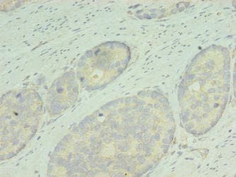 RDH12 / LCA3 Antibody (aa1-316)