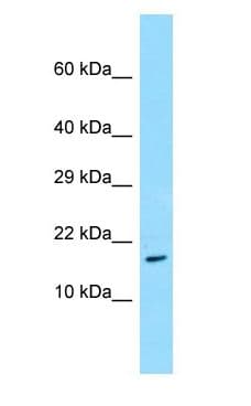 Polyclonal Rabbit anti-Human TRAPPC3 Antibody (aa28-77, WB)
