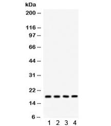 Polyclonal Rabbit anti-Human STMN1 / Stathmin / LAG Antibody (IHC, WB)