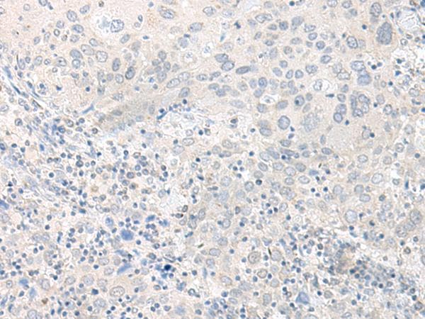 TIMM8A Antibody
