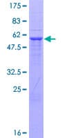 Human UHMK1 / KIS Protein (Recombinant GST)