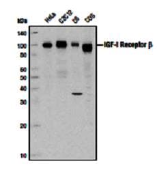 IGF1R / IGF1 Receptor Antibody (C-Terminus)