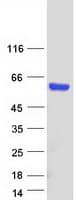 Human TBX1 Protein (Recombinant Myc-DDK (Flag))