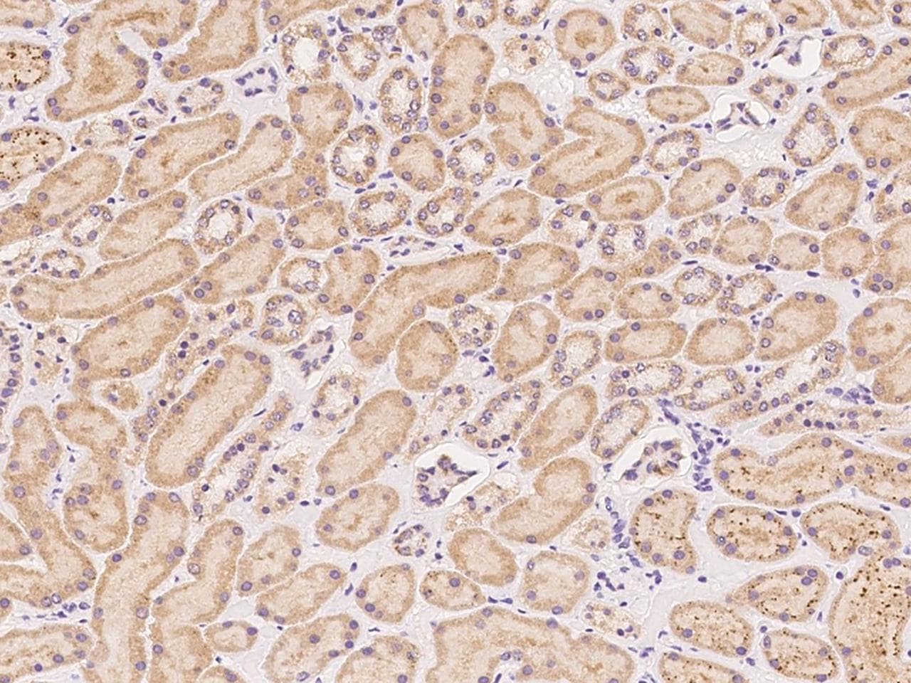 Polyclonal Rabbit anti-Human ZNF280B Antibody (IHC)