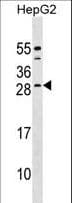 CABP4 Antibody (aa175-203)