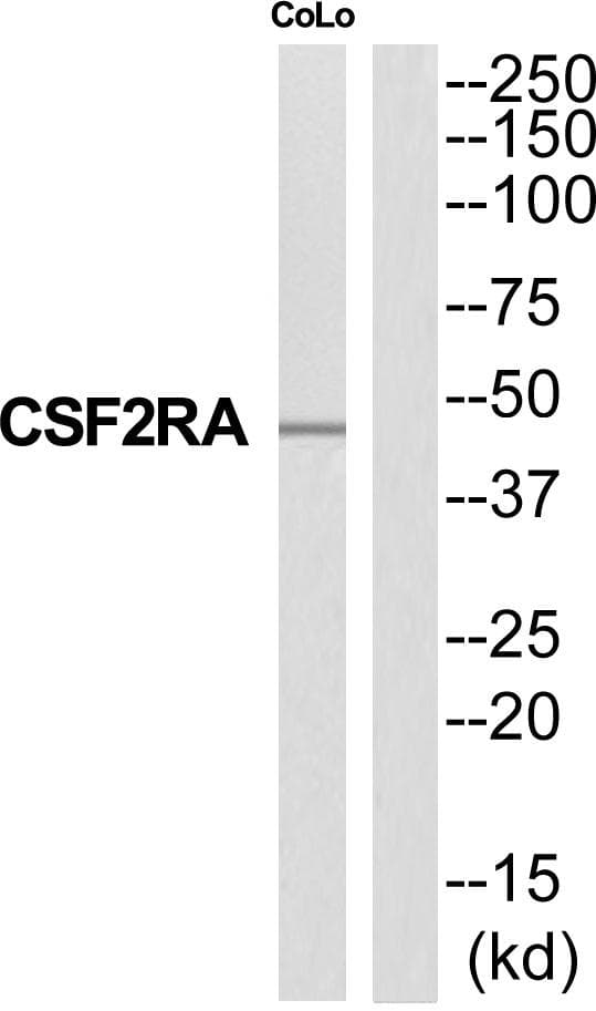 Polyclonal Rabbit anti-Human CSF2RA / CD116 Antibody (WB)