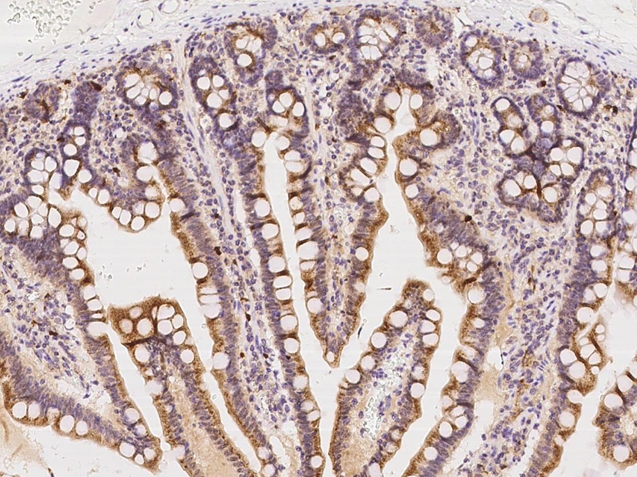 WRB Antibody