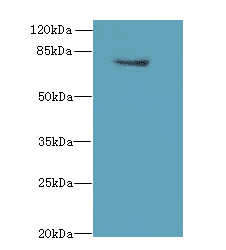 TMEM153 / LMF2 Antibody
