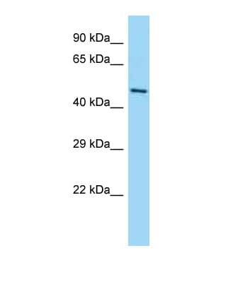 GPATCH2 Antibody (aa73-122)