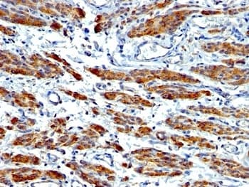 SMMHC / MYH11 Antibody (clone MYH11/923 + SMMS-1, Ready-to-Use)