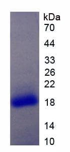 Human IL17RA Protein (Recombinant His, N-Terminal)