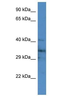 JPH4 Antibody (aa111-160)