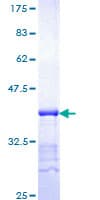 Human p16INK4a / CDKN2A Protein (Recombinant GST, N-terminus)