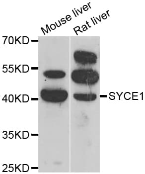 Polyclonal Rabbit anti-Human SYCE1 Antibody (IHC, IF, WB)