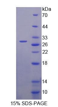 Human AK3 / Adenylate Kinase 3 Protein (Recombinant His-T7)