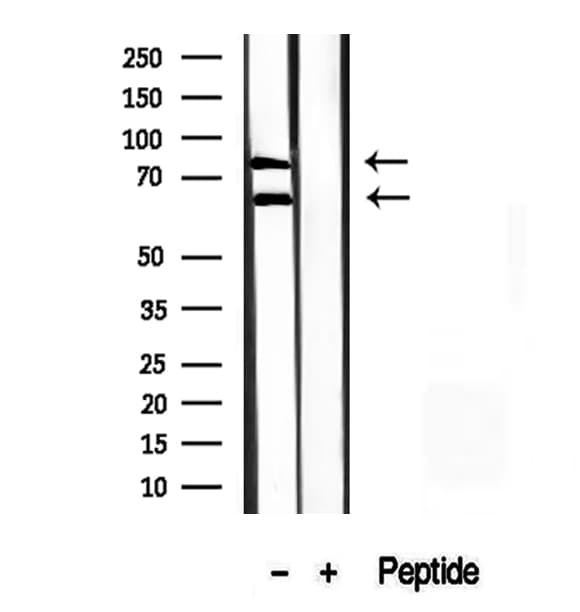 Polyclonal Rabbit anti-Human MLPH / Melanophilin Antibody (IHC, WB)