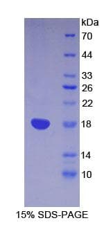 Mouse LY96 / MD2 / MD-2 Protein (Recombinant His, N-Terminal)