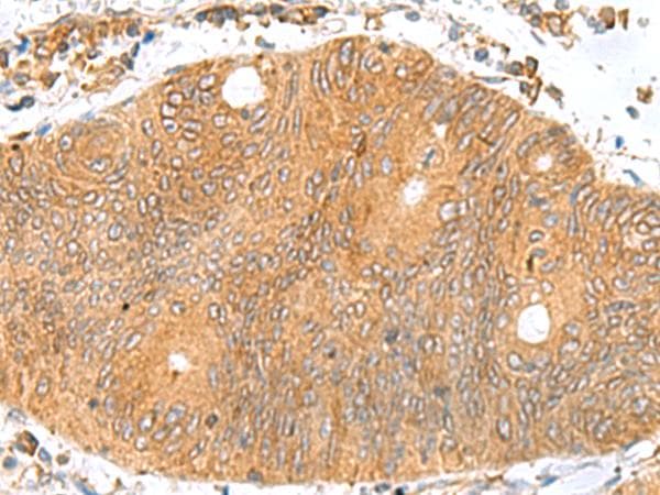 TXNDC12 Antibody
