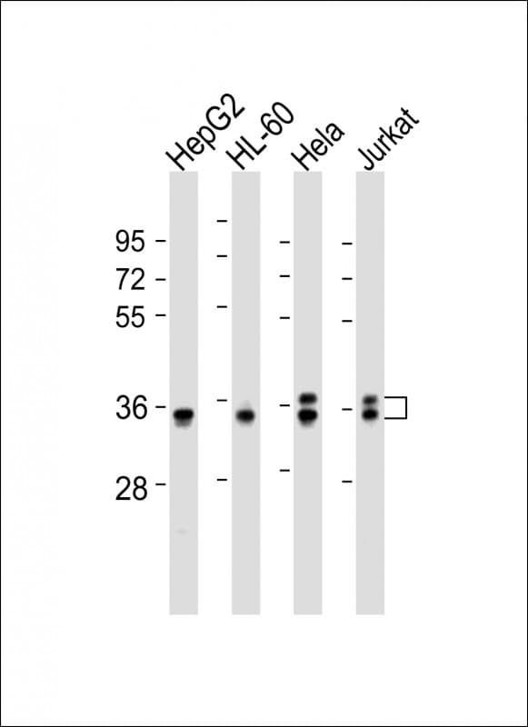 Polyclonal Rabbit anti-Human AKR7L Antibody (Internal, WB)